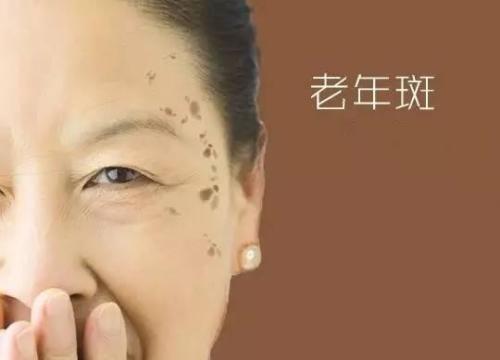 三七粉祛斑反馈